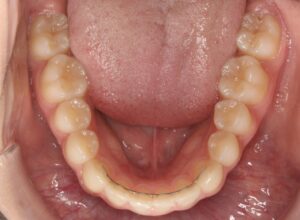 Inside Side View of Teeth
