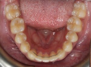 Inside of Mouth