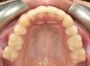 Inside View of Teeth