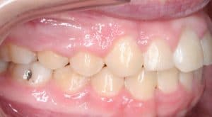 Orthodontist B4 17