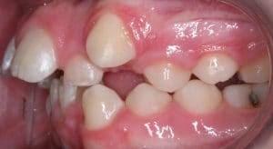 Orthodontist B4 26