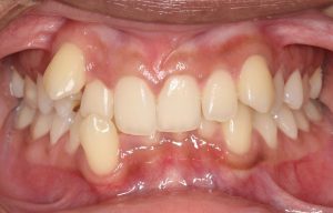 Orthodontist B4 24