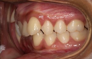 Orthodontist B4 23