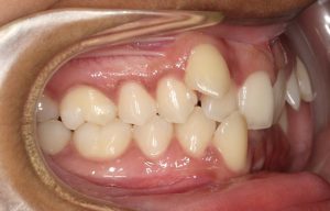 Orthodontist B4 22