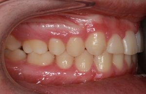 Orthodontist B4 20