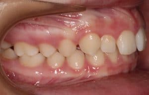 Orthodontist B4 21
