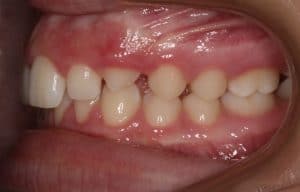 Orthodontist B4 19