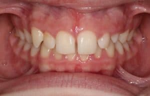 Orthodontist B4 18