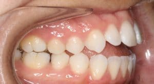Orthodontist B4 5