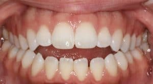 Orthodontist B4 3