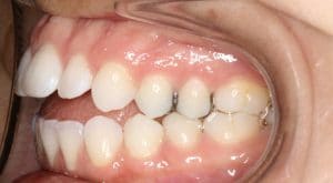 Orthodontist B4 4