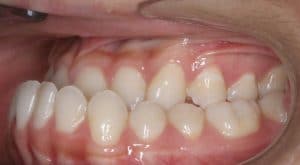 Orthodontist B4 7