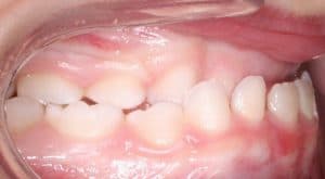 Orthodontist B4 14