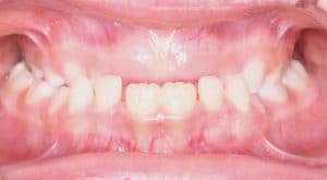 Orthodontist B4 16