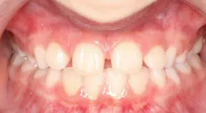 Orthodontist B4 13