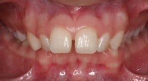 Orthodontist B4 2