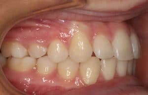 Orthodontist B4 11