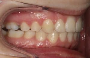 Orthodontist After 2